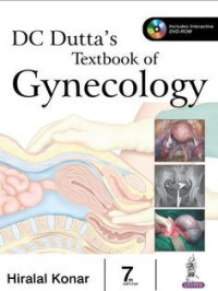 Image of DC Dutta's Textbook of Gynecology