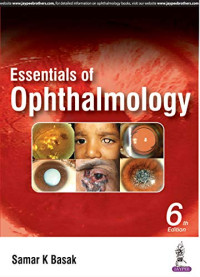 Image of Essentials of Ophthalmology